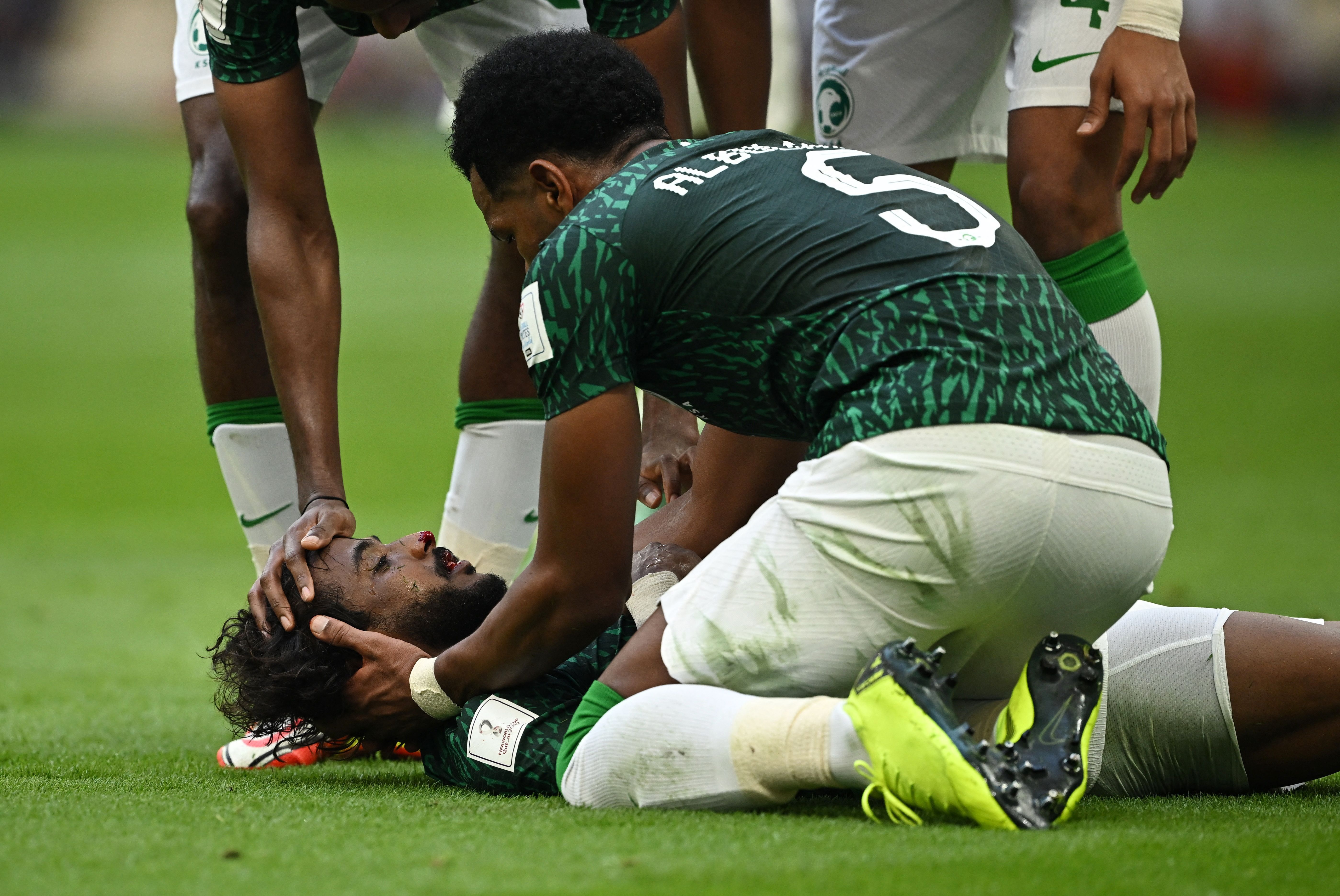Защитник Саудовской Аравии получил адскую травму в первом же матче на ЧМ. Что с ним теперь и куда он пропал?